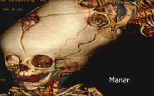 Scan of the Skulls